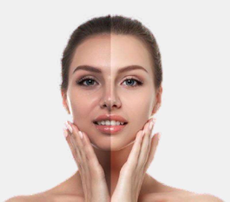 Pigmentation & Whitening Treatment